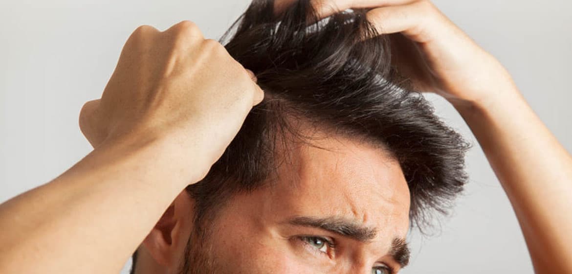 Hair loss  Symptoms and causes  Mayo Clinic