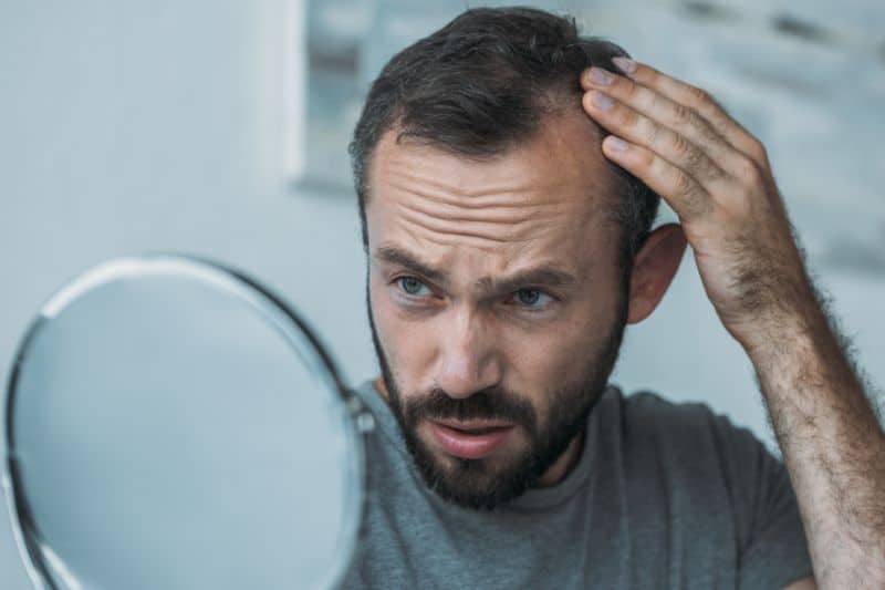 Risk factors involved in hair loss