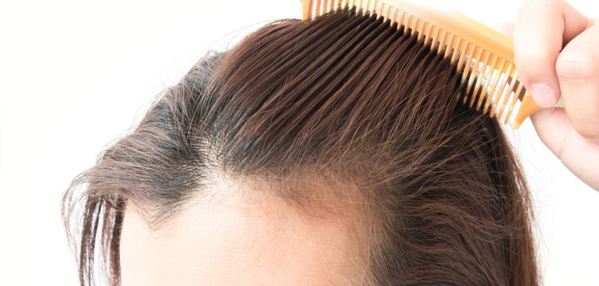 Hair Restoration Options for Women