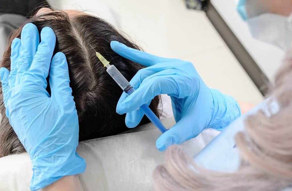 البلازما الغنية بالصفائح لمنع تساقط الشعر: أفضل الحلول غير الجراحية!